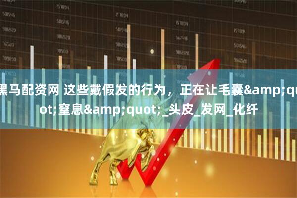 黑马配资网 这些戴假发的行为，正在让毛囊&quot;窒息&quot;_头皮_发网_化纤